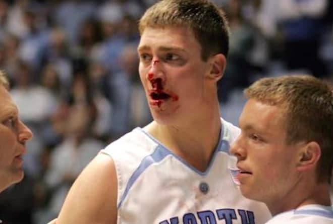 Tyler Hansbrough's bloody nose, courtesy of Duke's Gerald Henderson in 2007, is a truly memorable moment in UNC lore.